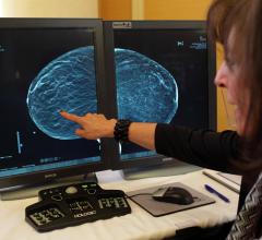 Hologic Receives FDA Approval for Low-Dose 3-D Mammography 