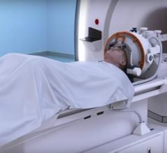 InSightec, ExAblate Neuro, MRI-guided focused ultrasound device, essential tremor, FDA