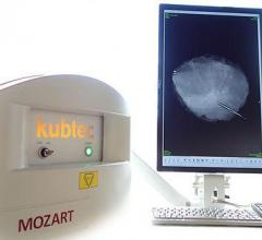 Kubtec Granted Additional Patent for Breast Specimen Imaging Using 3-D Tomosynthesis
