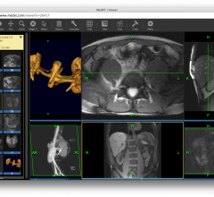 MedXT Announces FDA-Approved Universal Image Viewer