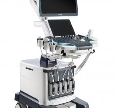 Mindray, Resona 7 premium ultrasound system, Zone Sonography Technology, ZST, RSNA 2015