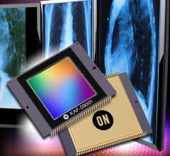 ON Semiconductor, KAF-09001 image sensor, video imaging, digital radiography, angiography, radiographic fluoroscopy, R/F systems