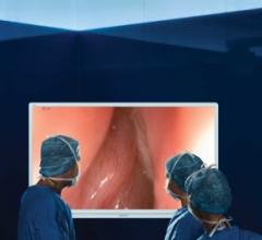 Olympus, Visera 4K UHD System, operative display, endoscopy, ultra-high definition