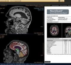 CorTechs Labs Receives FDA 510(k) Clearance for NeuroQuant for Quantitative Brain MRI Analysis