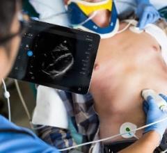 Philips, Lumify smart-device ultrasound, S4-1 cardiac transducer, RSNA 2016