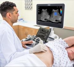Philips, FDA 510k clearance, ElastQ Imaging, shear wave elastography, ultrasound, liver tissue stiffness