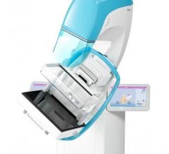 Planmed Clarity, 3-D digital breast tomosynthesis, DBT, 2-D full field digital mammography, CE Mark, Red Dot Design Award