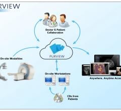 Purview, mammograms, earlier breast cancer detection, cloud access, American Journal of Roentgenology study
