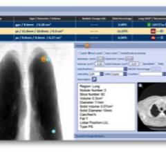 RADLogics, RSNA 2015, AlphaPoint image analysis software, lung cancer screening app, Chest CT Scan Module