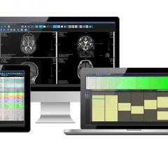 RamSoft, Remote Rendering software, image processing, streaming, RSNA 2016, RapidResults