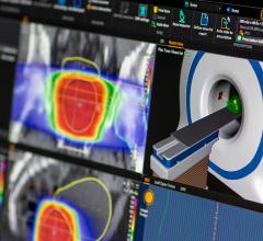 Eight Proton Therapy Centers Worldwide Adopt RayStation for Treatment Planning