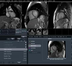 Johns Hopkins, motion-tracking MRI, stroke risk, atrial fibrillation