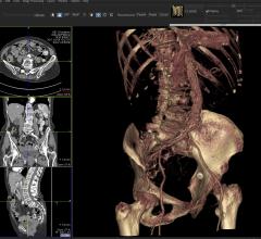 Telemis Medical PACS, version 4.7, JFR, integrated functionality, RSNA 2015