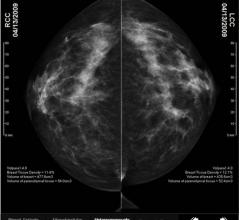 VolparaDensity, 3.1, tomosynthesis, mammography