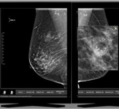 Three Palm Software, WorkStationOne, breast imaging workstation, RSNA 2016, version 1.8.2