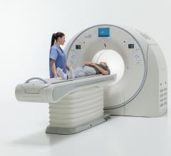 Toshiba, Aquilion One CT, model-based iterative reconstruction, MBIR, ACC 2017, FIRST, RSNA 2017