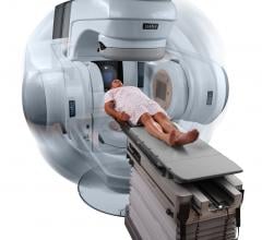 Varian, RapidArc, Yashoda Hospital, Hyderabad, India, 10,000th patient