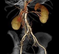 VitreaView Advanced Visualization 3-D