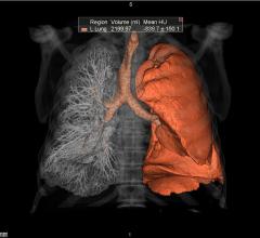 Vital, Vitrea Lung CT Analysis, Nuance PowerScribe 360, PenRad PenLung, RSNA 2016