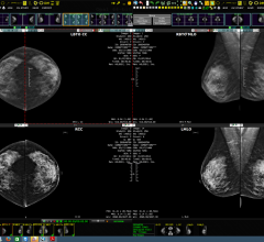 Viztek, Exa Mammo Viewer, breast imaging management workstation, RSNA 2015