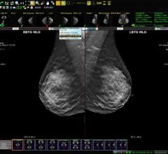 Viztek, Exa PACS, picture archive and communication system, EHR, RSNA 2014