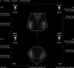 Volpara, Density Maps, breast density measurement, FDA clearance