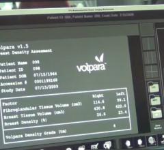 Volpara, VolparaDensity, version 3.0, RSNA 2014
