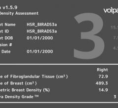 fibroglandular breast density, breast cancer screening performance, Breast Cancer Research and Treatment study, Volpara Density