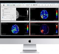 aycan OsiriX PRO PACS Oncology information management system (OIMS) RSNA 2014