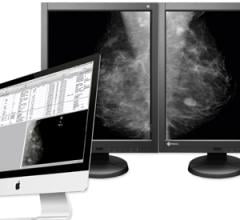 aycan, Mammography Workstation, Eizo monitors