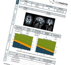icometrix, icobrain, MRI brain scans, longitudinal measurements, RSNA 2016, FDA clearance