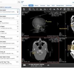 lifeIMAGE, version 5.0, medical image viewing platform, RSNA 2016, eUnity Collaboration