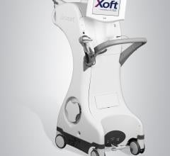 Xoft Electronic Brachytherapy System Effective Long-Term for Early-Stage Breast Cancer