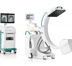 Ziehm Imaging will showcase its leading portfolio of mobile C-arms and advanced pre- and intraoperative image-based decision support solutions on its virtual RSNA 2020 booth