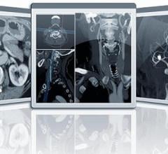 ayDCE software, mpMRI, multiparametric magnetic resonance imaging, prostate MRI, RSNA 2017, AHRA, SIIM