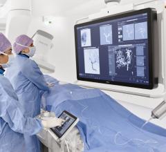 Philips announced its next-generation Philips Azurion image-guided therapy platform, marking an important step forward in optimizing clinical and operational lab performance and expanding the role of image-guided interventions in the treatment of patients.