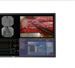 Barco, MultiSense Develop Telemedicine System for Heart Surgery Master Class