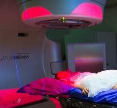 radiotherapy, radiation therapy, CHLA, Children's Hospital Los Angeles study, young children, brain tumors, outcomes, Pediatric Blood & Cancer
