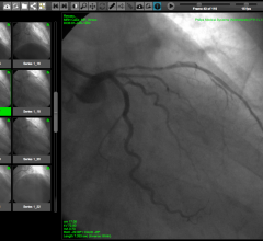 WebPAX, Heart Imaging Technologies, PACS, Cardiac PACS, Echo Imaging