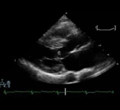  Turnkey National Tele-Echocardiography Program Offered for Mobile Ultrasound Companies, Hospitals