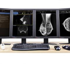 pacs RIS mammography reporting software RSNA women intelerad inteleris