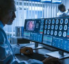 AI-enhanced scanning provides a greater level of detail for MRI technologists and physicians.