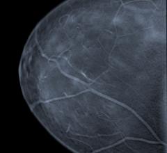 FDA MQSA Mammography Full-Field Digital FFDM Women's Health 