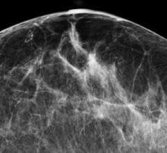 American College of Radiology ACR Society of Breast Imaging SBI Mammography