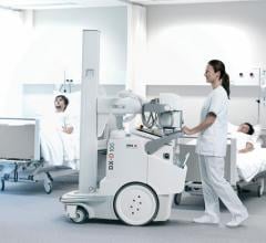 mobile DR, digital radiography, X-ray, Agfa, DX-D 100