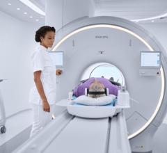 Helium Crisis Presents Potential MRI Challenges