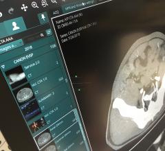 Canon's Vitrea PACS enterprise imaging system was one of several systems demonstrated at HIMSS 2021 that had easily modified hanging protocols. This included ease of use to customize what each radiologists prefers, including slice thickness. #HIMSS #HIMSS21