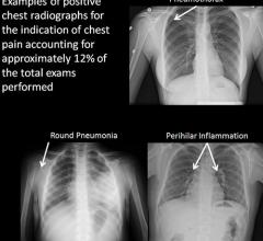 children, x-rays, Mayo Clinic, unnecessary, RSNA 2014, study