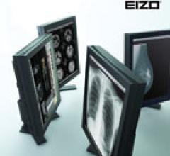 All Eizo medical-grade monitors are adjusted for uniform brightness and DICOM calibration