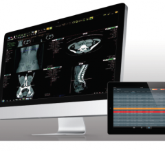 Exa is an integrated PACS, RIS and Billing platform that is scalable to adapt to the needs of various imaging providers